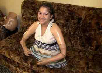 Еля от Разград – детето без крайници, което се усмихва на живота /ВИДЕО/