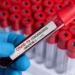 Doctor with blood sample of Covid-19 Omicron B.1.1.529 Variant and general data of covid-19 Coronavirus Mutations.