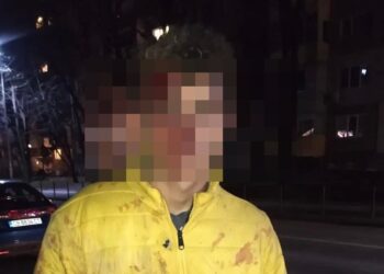 Разследват сигнал за нанесен побой над 17-годишен младеж от Русе